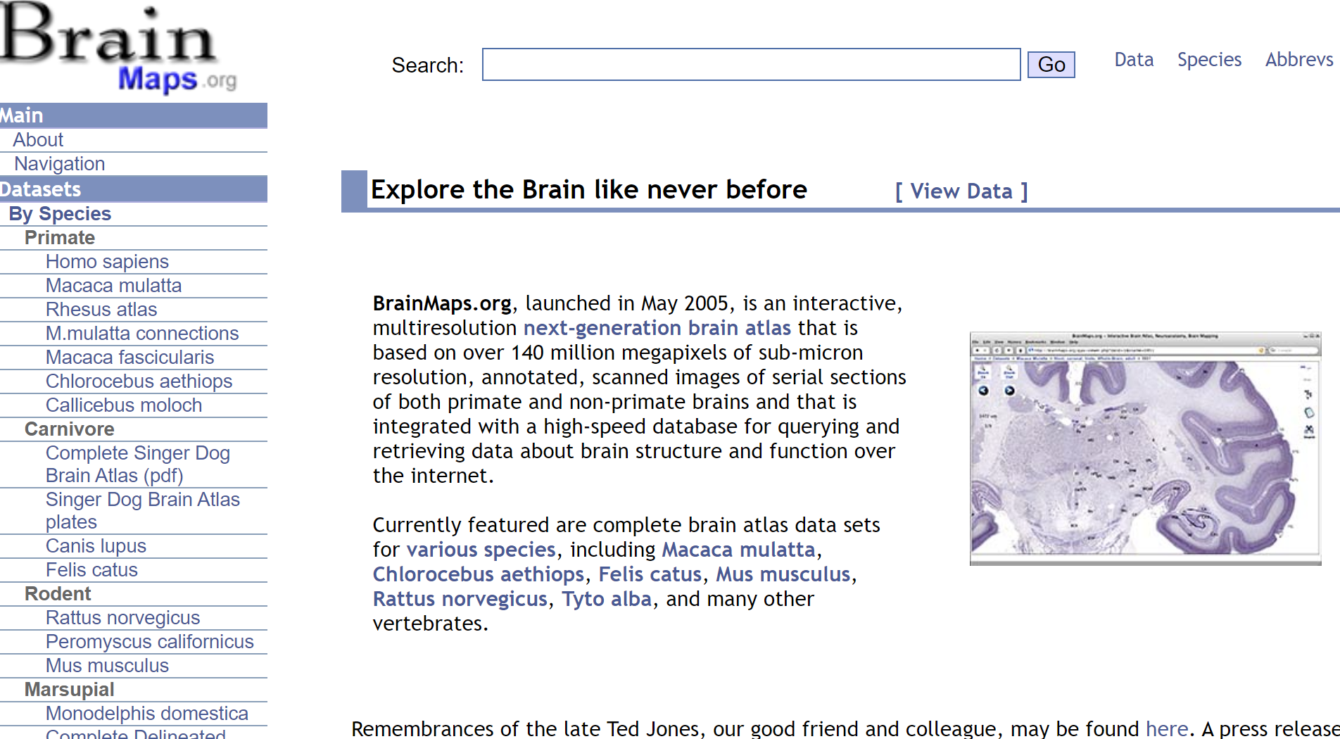 Websites to use to learn Neuroanatomy for free